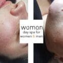New Treatment Alert ? At Woman Beauty Day Spa