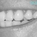 We Are Pleased To Say We Will Be Back At Work From Tomorrow 8.9.21 As Usual: Quin Dental