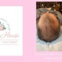 Spring Is Sprouting And So Can That Thinning Hairline: Mabin House Body & Skin Sanctuary